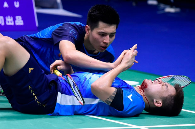 Teo Ee Yi's face is marred by sweat and blood during the 2019 Sudirman Cup quarter-final. (photo: AFP)