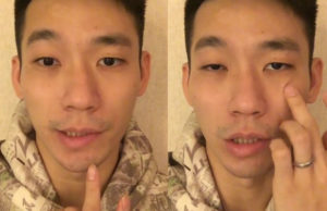 Chan Peng Soon reveals he has Bell's Palsy. (photo: Chan Peng Soon's Facebook)