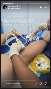 Tee Kai Wun posted on social media that he is undergoing leg therapy after the Hylo Open semi-final. (Photo: Tee Kai Wun’s IG)